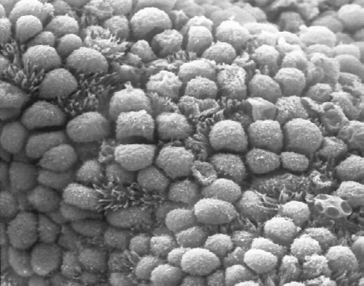 FIGURE 1 Pinopode formation in endometria of control and letrozole-treated cycles evaluated by scanning electron microscopy.