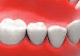 oral cavity then tighten it to 25~30N cm.