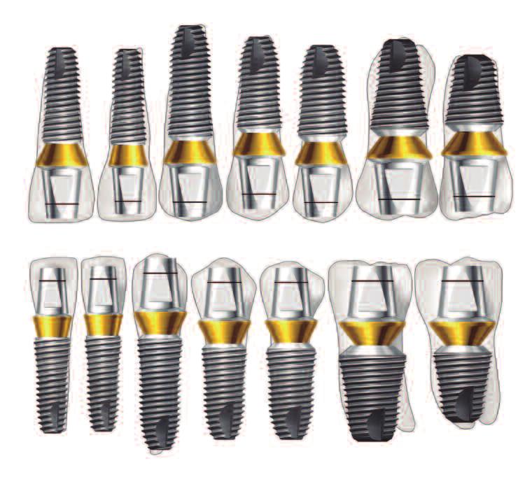 SuperLine & Implantium Surgical / Prosthesis Manual 13 Types of Abutment One-Piece Two-Pieces Hex Non-hex Hex Non-hex Combi Abutment Dual Abutment Dual Milling Abutment (15 )