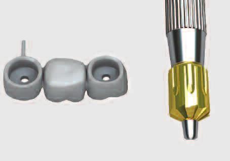 master cast Removal of impression coping Connect the screw abutment