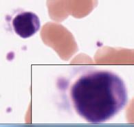 432) lung EM 8f Monocyte