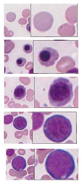 RBCs Basophilic erythroblast Orthochromatophili c erythroblasts Late polychromatophilic erythroblast ut