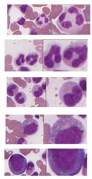 Granulopoiesis Neutrophils Lobulated, dark nucleus, mature grey cytoplasm with small granules Neutrophilic band or stab cells Horse-shoe shaped, darkening nucleus, grey mature cytoplasm Neutrophilic