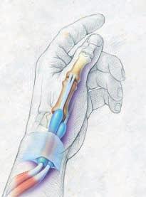 Inside Your Thumb Tendons connect muscles in your wrist and forearm to the bones in your thumb. The tendons are surrounded by a protective tendon sheath.