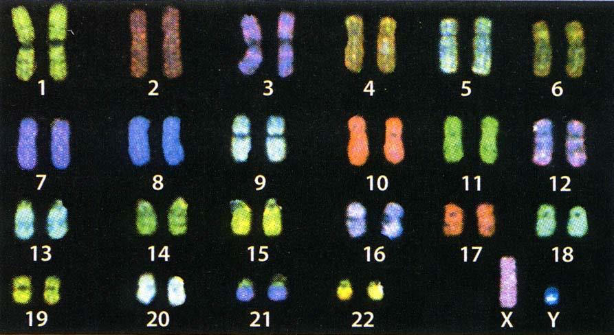 Human Primary Sex Determination 1. gonadal determination 2. chromosomal a.