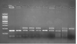 63 +/-19.69 Bone marrow cellularity N (%) Normo-cellular 60 (85.7) Hyper-cellular 10 (14.3) FLT status N=67 (%) FAB Wild 40 (59.7) Mutant 27 (40.3) M1 19 (27.1) M2 24 (34.3) M4 24 (34.3) M5 3 (4.