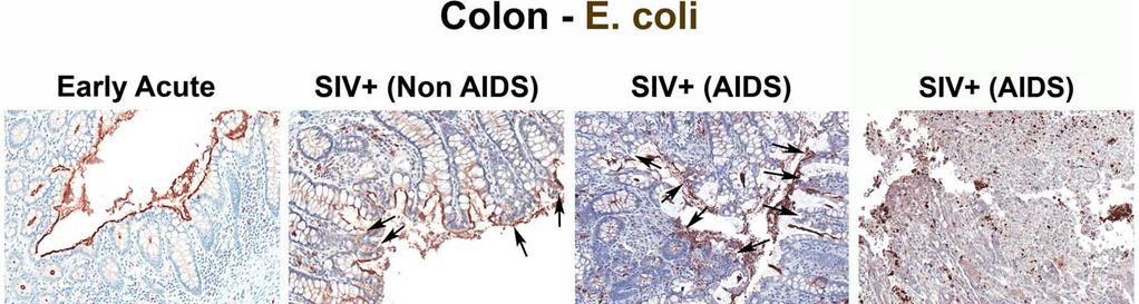 Figure 2. Identification of microbial translocation in large bowel of chronically SIV + RMs. Representative images (2006) of colon stained with a polyclonal antibody against E.