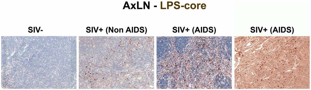 Figure 4. Identification of systemic microbial translocation in distant AxLN of chronically SIV + RMs. Representative images (2006) of the paracortex of AxLN stained for LPS-core antigen (brown).