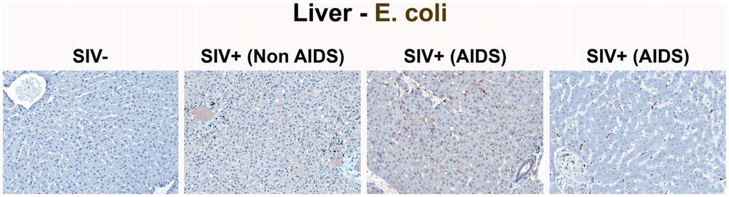 but the paucity of LPS staining seen in SIV-uninfected RMs. doi:10.1371/journal.ppat.1001052.g004 bial products and the innate proinflammatory cytokine IFNa.
