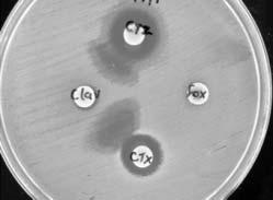 5 McFarland of test isolate was swabbed on Mueller Hinton Agar (Difco) plates and disk of cefotaxime (30 µg) and ceftazidime (30 µg) were placed adjacent to clavulanic acid (10 µg) and Cefoxitin (30