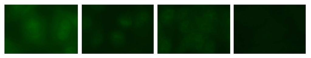 Anti-CADM140 (clinically amyopathic dermatomyositis)/ MDA5 (melanoma differentiation associated gene 5) ~140kD single protein ANA weak cytoplasmic staining or negative MDA5 is a cytoplasmic innate