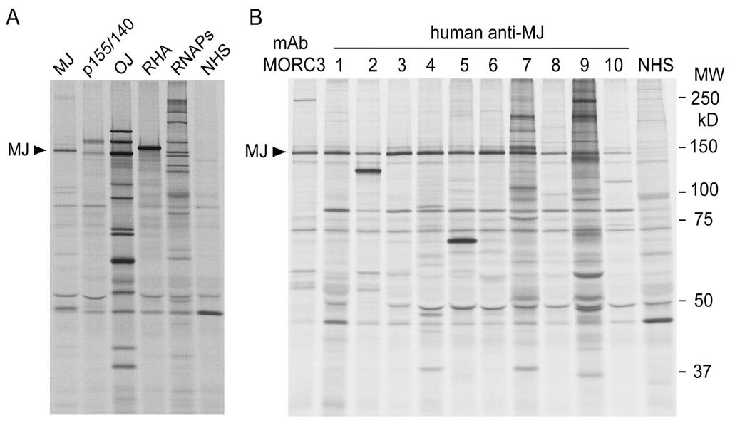 Anti-MJ (NXP-2, MORC3) antibodies Ceribelli A et al.