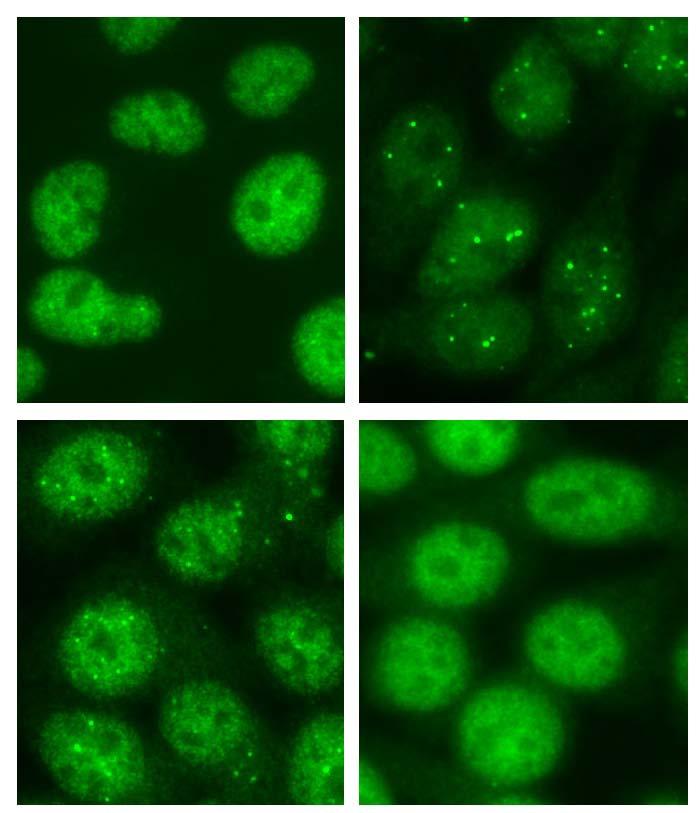 Anti-MJ (NXP-2, MORC3) antibodies Target protein (MJ antigen) was identified as: NXP-2 (nuclear matrix protein 2) MORC-3 (microchidia family
