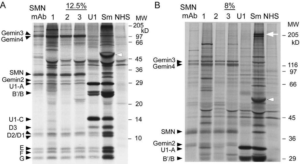 Antibodies that immunoprecipitate D-E-F-G recognize SMN (survival of