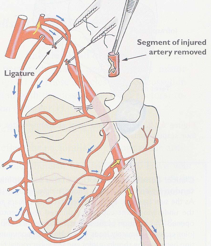 axillary artery.