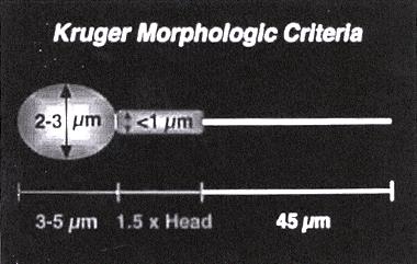 FIGURE 1. Criteria for Kruger strict morphology. All borderline forms are classified as abnormal. Abnormal head forms include tapered, pyriform, duplicated, macro, micro, and amorphous.