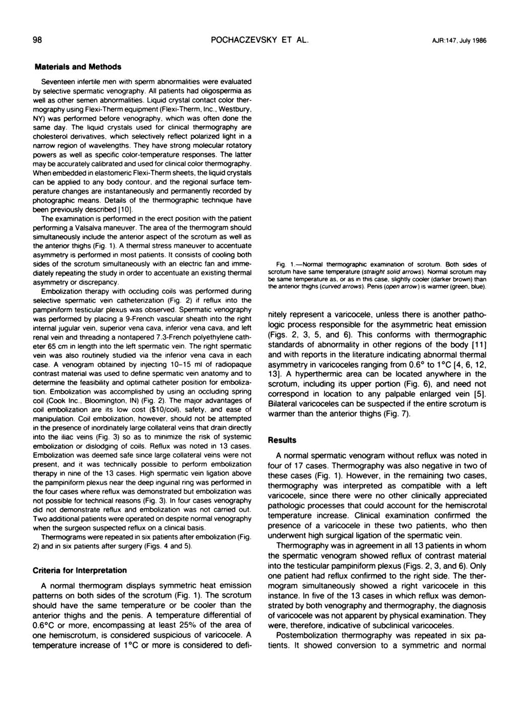 98 POCHACZEVSKY ET AL. AJR:147, July 1986 Materials and Methods Seventeen infertile men with sperm abnormalities were evaluated by selective spermatic venography.