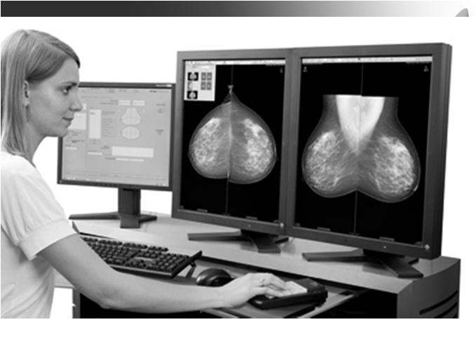 The IDI Mammography Workflow Solution can help enhance your performance through seamless RIS/MIS/PACS connectivity, easy collaboration, and review