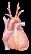 Effects of Neprilysin Inhibition in Heart Failure Endogenous vasoactive peptides (natriuretic peptides, adrenomedullin, bradykinin, substance P, calcitonin gene-related peptide) Neurohormonal