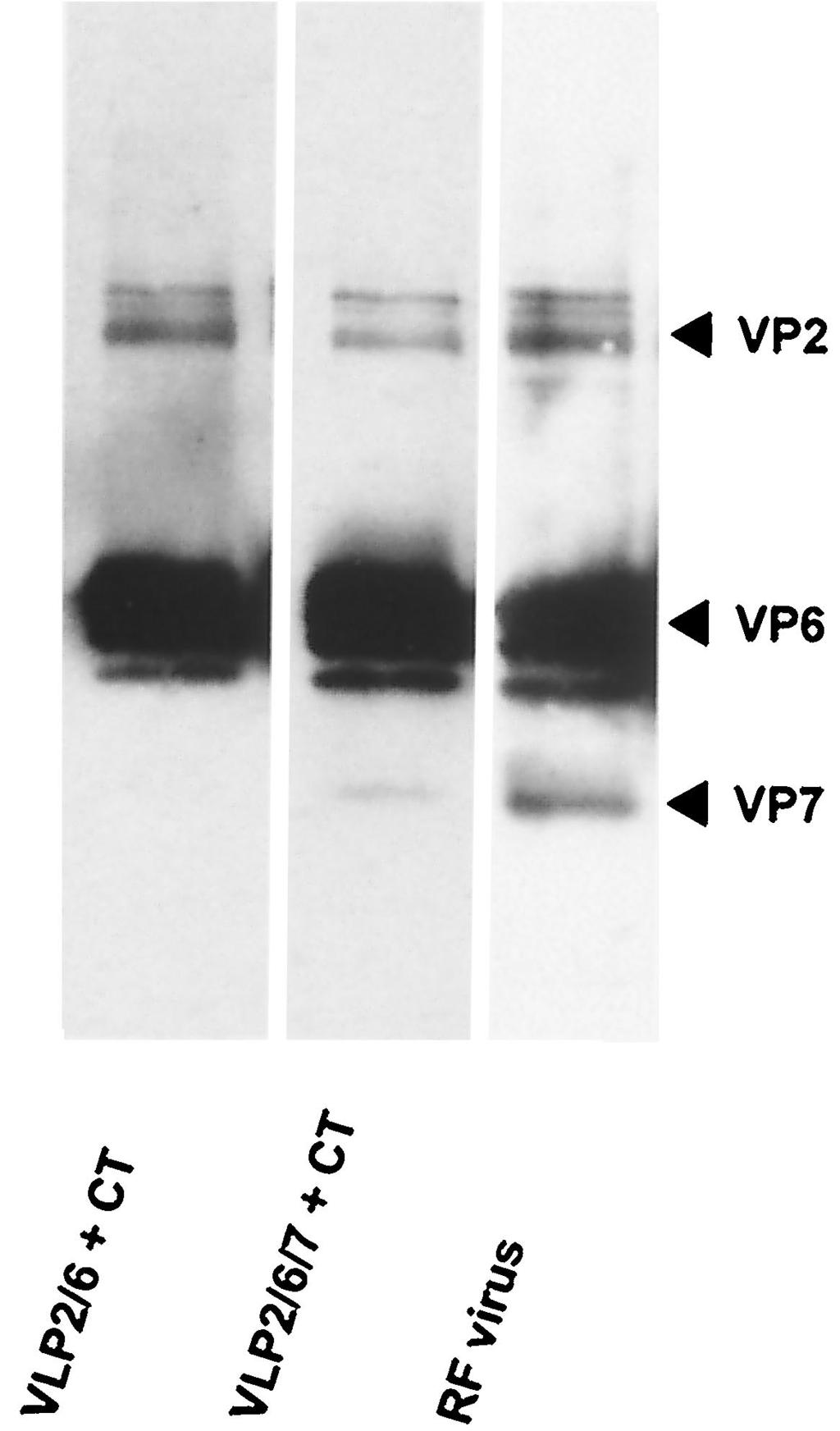 serum against RF virus (lane 3) as positive control were tested by immunoblot. FIG. 2. Antibody response elicited by nasal immunization with VLPs.