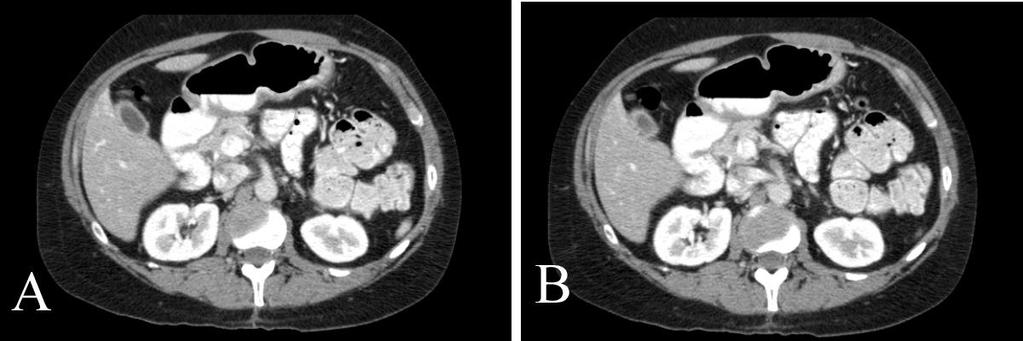 6/23/2012 Radiology Quiz of the Week #78 Page 3 IMAGING STUDY AND QUESTIONS The patient underwent imaging: Imaging questions: 1) What