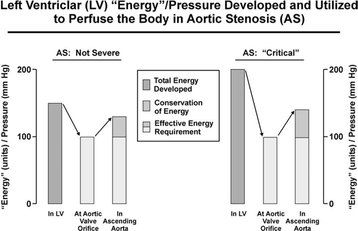 Other Issues with AV Gradients by ECHO/Doppler Energy losses Non-uniform velocity profiles Omission of upstream velocity Gradients assessed at valve level Gradient after pressure recovery is more