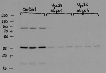 WB: GFP (lower exp) Figure 4h, cont WB: