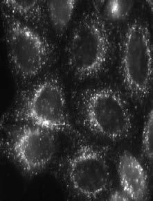72 hours post-transfection, cells were fixed and stained with antiodies against SNX1