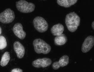 (a) Untransfected HeLa cells, or