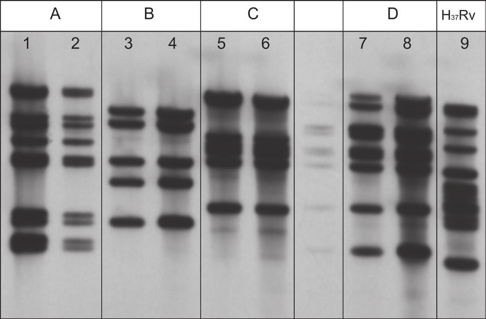 292 Żaczek A. et al. 3 Fig. 2. DNA profiles obtained with IS6110-RFLP method.