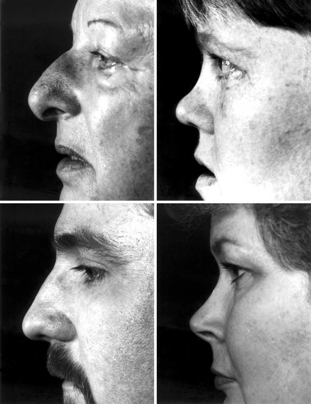 C+ C P+ P Figure 2. (cont) Case Examples General examples of abnormalities in each of the categories can be seen in the photographs in Figure 2.