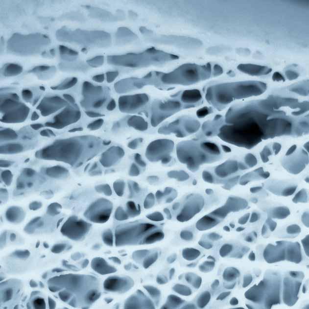 Synthetic cancellous bone graft substitute Avoids bone harvesting Autologous bone grafting is associated with several shortcomings and potential complications.