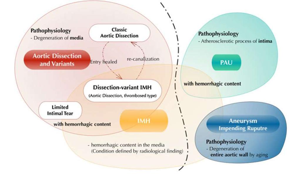 IMH & PAU - complex entities within Acute Aortic