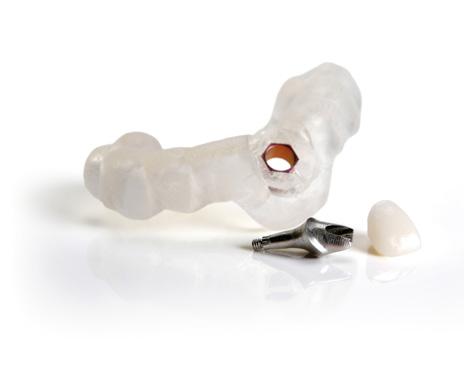 Immediate Smile featuring Atlantis Abutment Advantages Patients want beautiful and functioning teeth both quickly and with optimal long-term results.