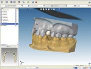 The core file is a digital file that includes the Atlantis Abutment design and the soft tissue, the neighboring teeth and if provided the opposing dentition all in correct relative position.