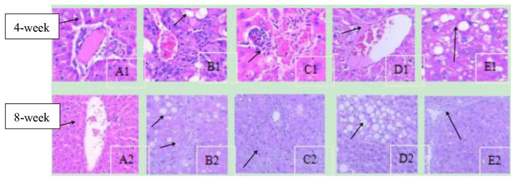 D1, intervention group: H&E staining, 100X, mild edema of liver cells. E1, natural recovery group: H&E staining, 100X, moderate edema of liver cells.