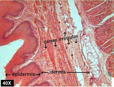 More dense irregular Dense irregular: for what to look Mesh of collagen fibers