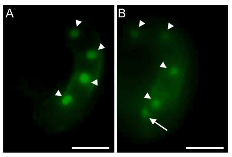 Figure S6 Analysis of persistent synergid nucleus in seeds from jagger-/- pistils pollinated with AGL62:GFP pollen. A. Four nuclei endosperm stage ovule from wild-type plants containing the AGL62:GFP construct.