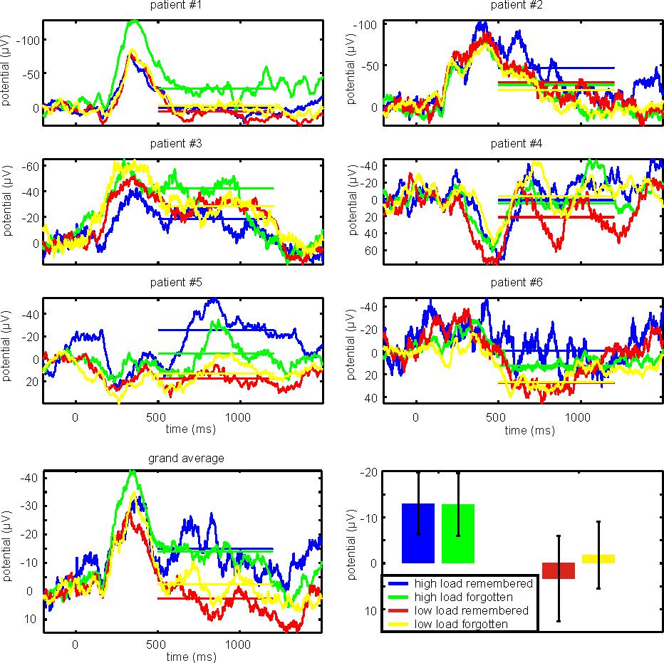 Working memory long-term memory interaction 181 Fig. 3. Averaged ERPs in the hippocampus.