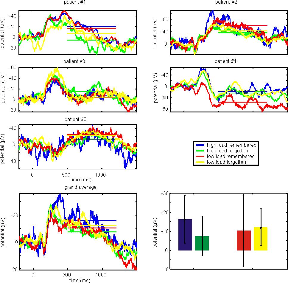 Working memory long-term memory interaction 183 Fig. 5. ERPs in the rhinal cortex. ERPs averaged across all rhinal contacts are shown both for each subject and averaged across subjects (bottom).