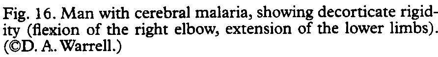 TRANSAC11ONS OFTHE ROYAL SOCIETY OF TROPICAL MEDICINE AND HYGIENE (2000) 94, SUPPLEMENT 1 Fig. 18.