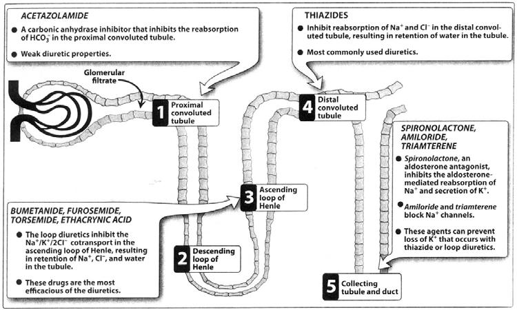 Nephron Thiazide Diuretics - Adverse effects - hypokalemia, hypercalcemia - uric acid retention gout - can cause