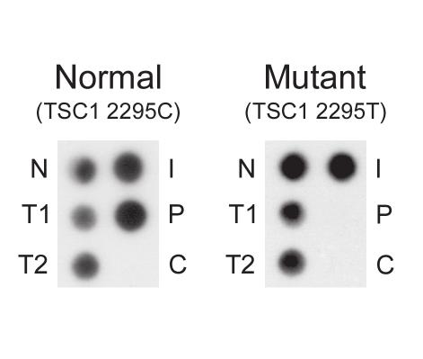 Chapter 10 Figure 2 Allele specific oligonucleotide hybridisation analysis of the TSC1 R692X (2295 C-T) mutation.