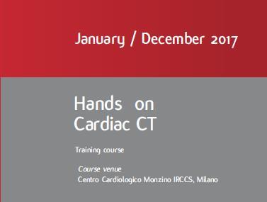 THANKS Director of Cardiology Prof. Cesare Fiorentini, MD www.cardiologicomonzino.it Gianluca.