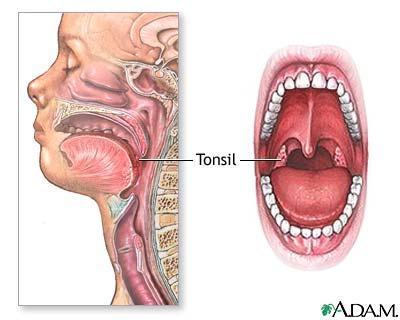 Tonsils Palatine