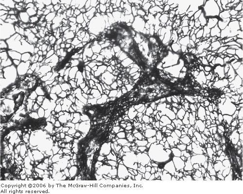 Lymphoid Tissue Free cells Network of reticular fibrils Dense lymphoid