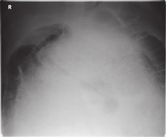 Plain radiographs demonstrated massive faecal loading but nil else (Figures 1 and 2).