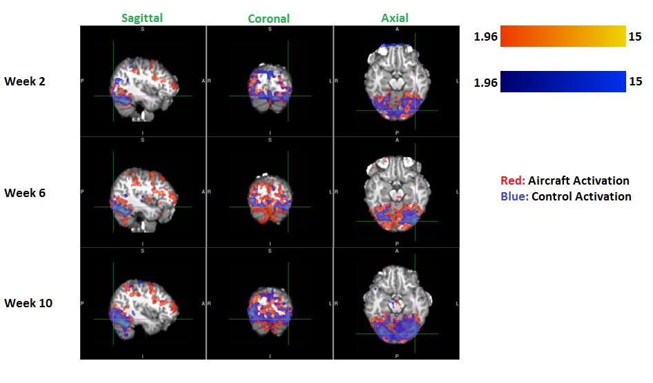 Figure A.8: Activation images for subject 4 showing activation in occipital lobe for three weeks.