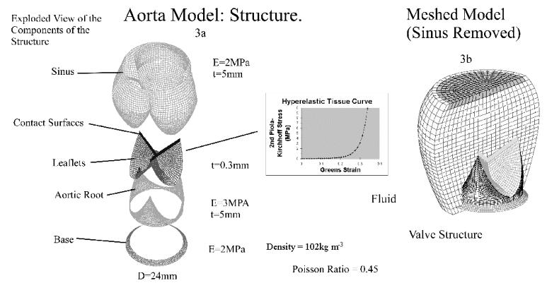 Figure 3. Exploded view of the aortic valve structure showing (a) the dimensions and material properties used, and (b) the leaflets of the valve embedded in the containing fluid control volume.