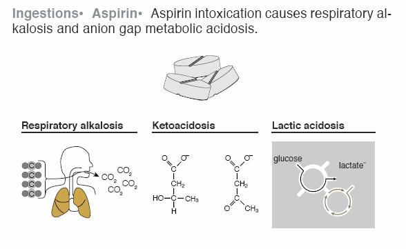 Aspirin overdose Treatment of Aspirin